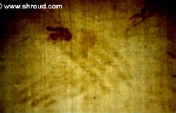 xray image of hands on shroud 