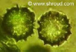 pollen under a microscope 